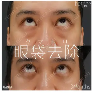 before image