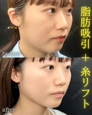 30 days after image