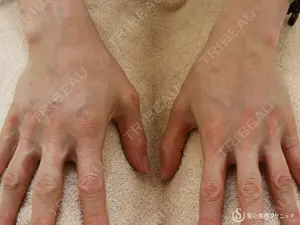 null days after image