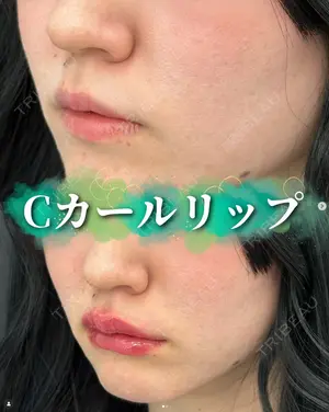 0 days after image