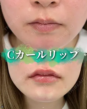 0 days after image