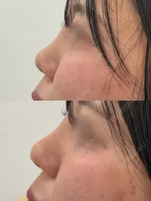 0 days after image