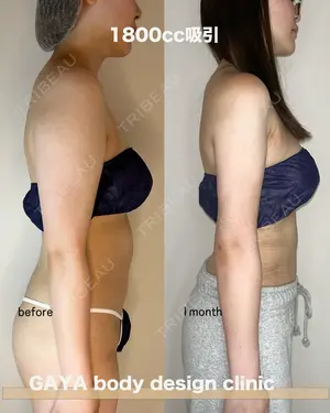 30 days after image