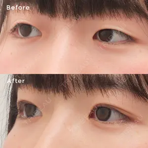 before image