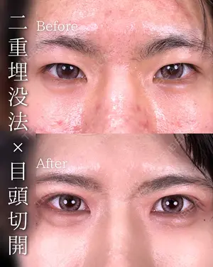before image