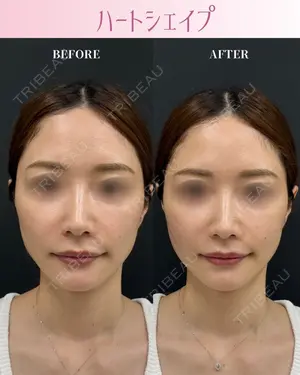 0 days after image