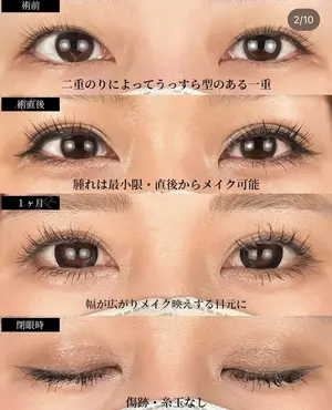 before image