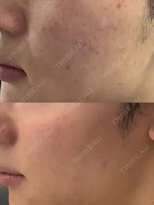 180 days after image