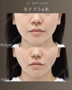 0 days after image