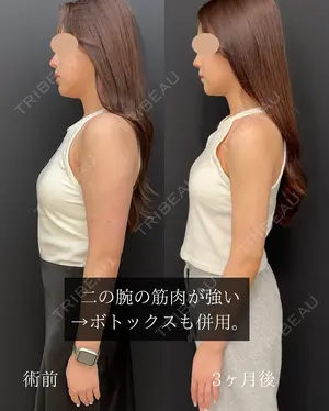 90 days after image