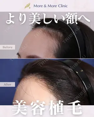 before image