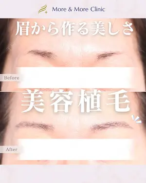 14 days after image