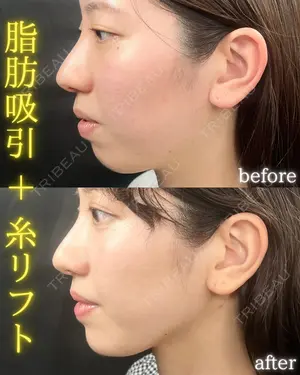30 days after image