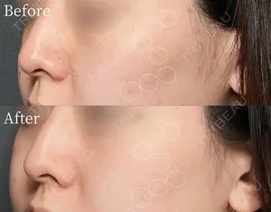before image