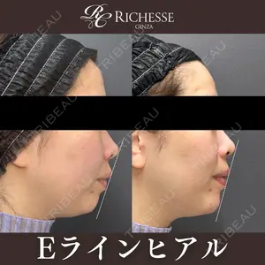 before image
