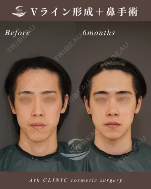 before image