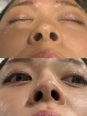 0 days after image