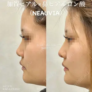 null days after image