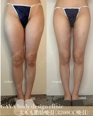 30 days after image
