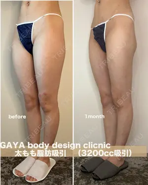 30 days after image