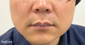 before image