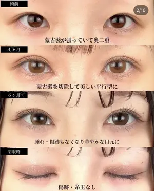 before image