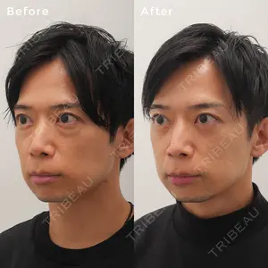 before image