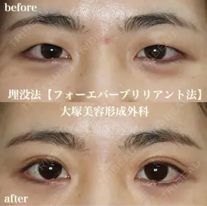before image