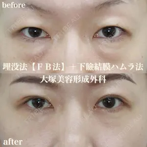 before image