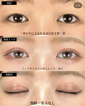before image