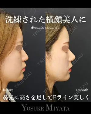 30 days after image