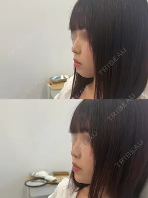 before image