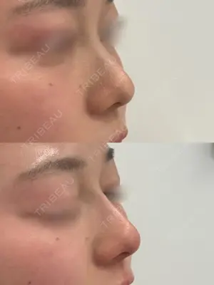 0 days after image