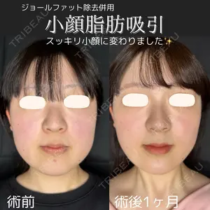 30 days after image