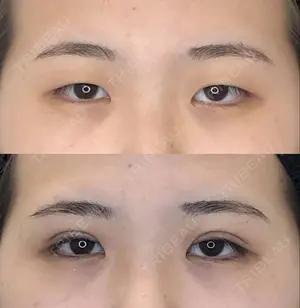 null days after image