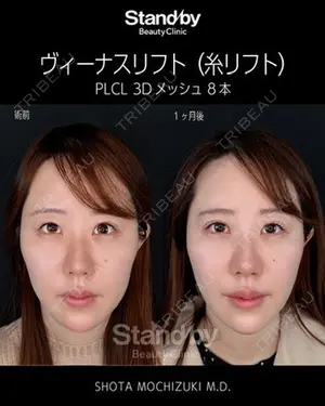 30 days after image