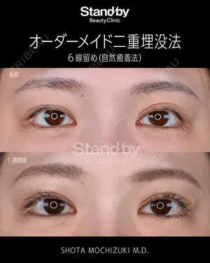7 days after image