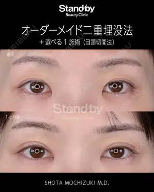 before image