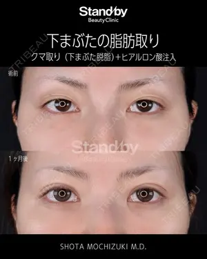 30 days after image