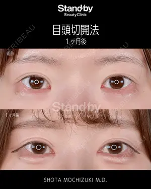 30 days after image