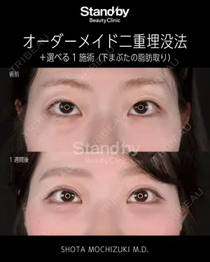 before image