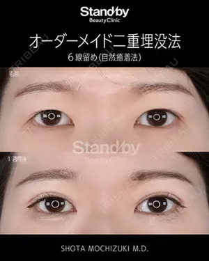 7 days after image