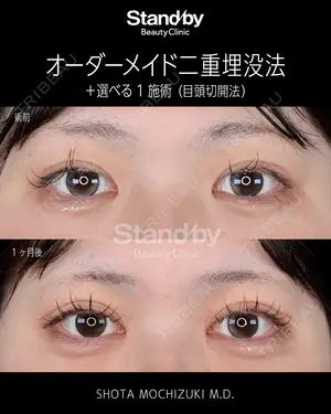30 days after image