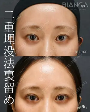 before image