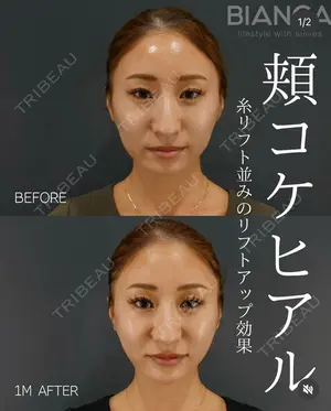 before image