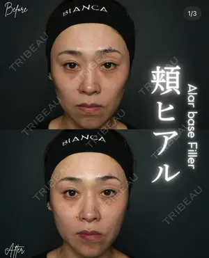 before image