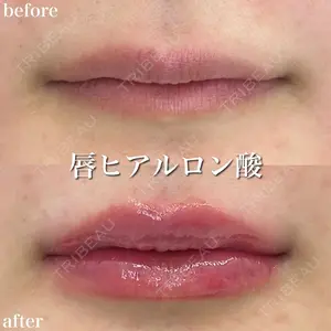 0 days after image