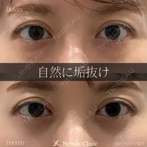 30 days after image