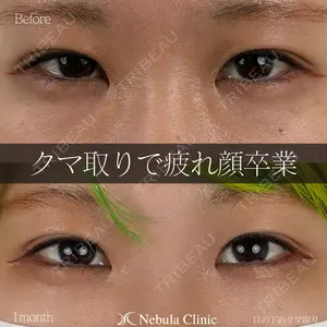 before image