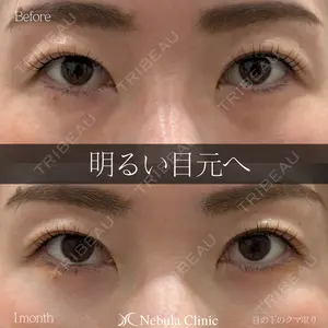 before image
